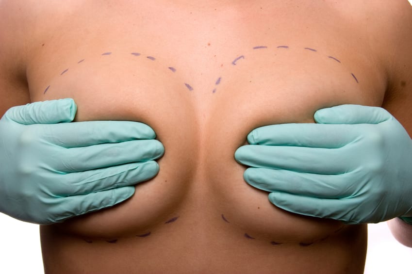 breast augmentation boob job chicago il