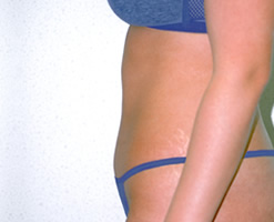After Image: Patient # 50416 - 