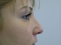 After Image: Patient # 49021 - 