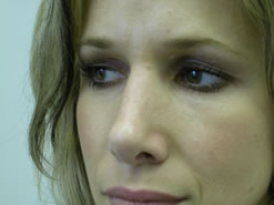 After Image: Patient # 63119 - 
