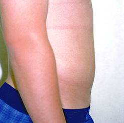 After Image: Patient # 32327 - 