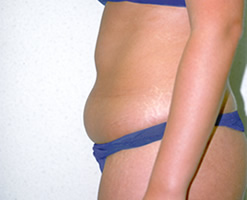 Before Image: Patient # 50416 - 
