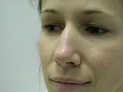 Before Image: Patient # 63119 - 