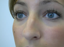 Before Image: Patient # 71892 - 
