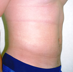 After Image: Patient # 32327 - 