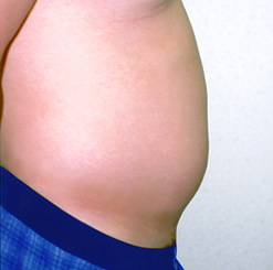 Before Image: Patient # 32327 - 