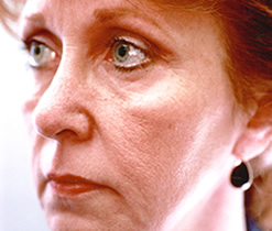 Before Image: Patient # 67509 - 