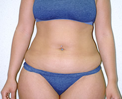 Before Image: Patient # 50416 - 