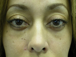 After Image: Patient # 72282 - 