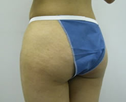 Before Image: Patient # 56076 - 