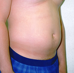 Before Image: Patient # 32327 - 