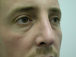 After Image: Patient # 79878 - 
