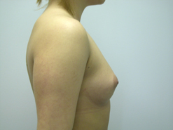 Before Image: Patient # 27850 - 