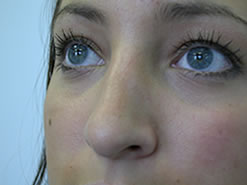After Image: Patient # 71892 - 