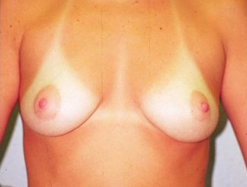 Before Image: Patient # 77447 - 
