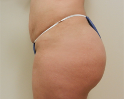 After Image: Patient # 21691 - 