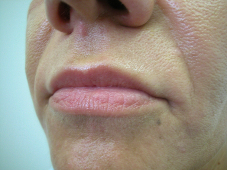 After Image: Patient # 97248 - 