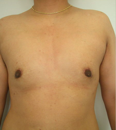 After Image: Patient # 39379 - 