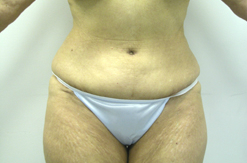 After Image: Patient # 37783 - 
