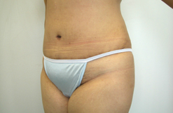 After Image: Patient # 27742 - 