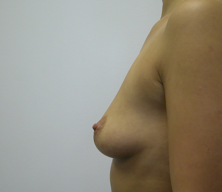 Before Image: Patient # 34636 - 