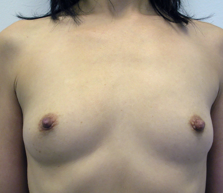 Before Image: Patient # 65806 - 