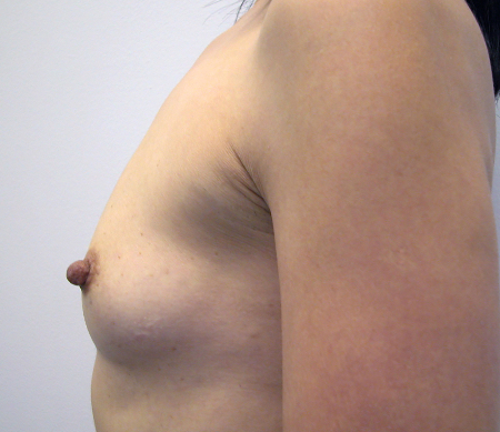 Before Image: Patient # 65806 - 