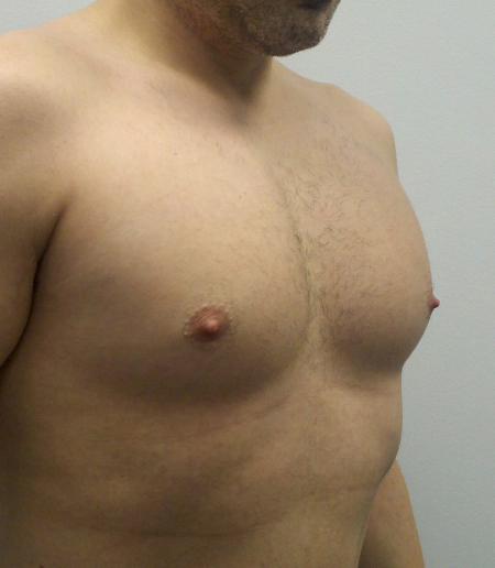 After Image: Patient # 74223 - 