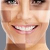 3 Benefits of PCA Peels PCA Peels Chicago, IL