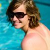 Burn Baby, Burn: What to Know About Sunburns Med Spa Chicago, IL