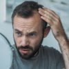 8 Things You Should Know about Neograft Hair Restoration NeoGraft Chicago, IL