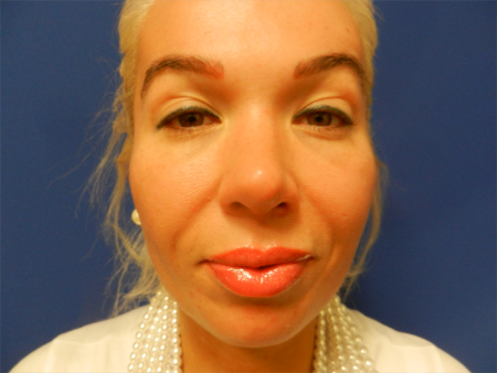 After Image: Patient # 10257 - 