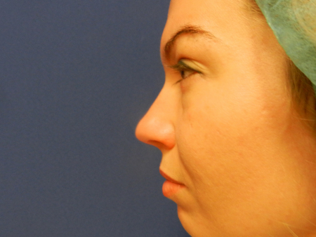 Before Image: Patient # 10257 - 
