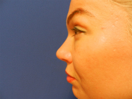 After Image: Patient # 10257 - 
