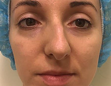 Before Image: Patient # 67046 - 