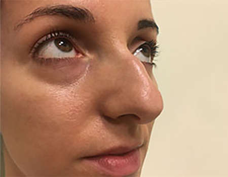 Before Image: Patient # 67046 - 