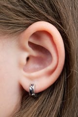 earlobe repair Chicago IL