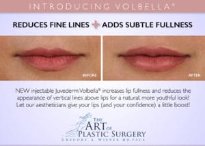 Volbella™ Injectable Lip Filler Chicago IL