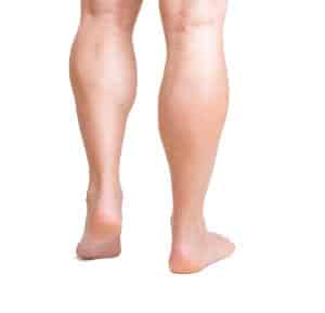 shutterstock 164601389 300x289 1 Calf Implants Chicago IL