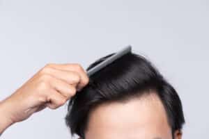 Close,Up,Photo,Of,Clean,Healthy,Man's,Hair.,Young,Man