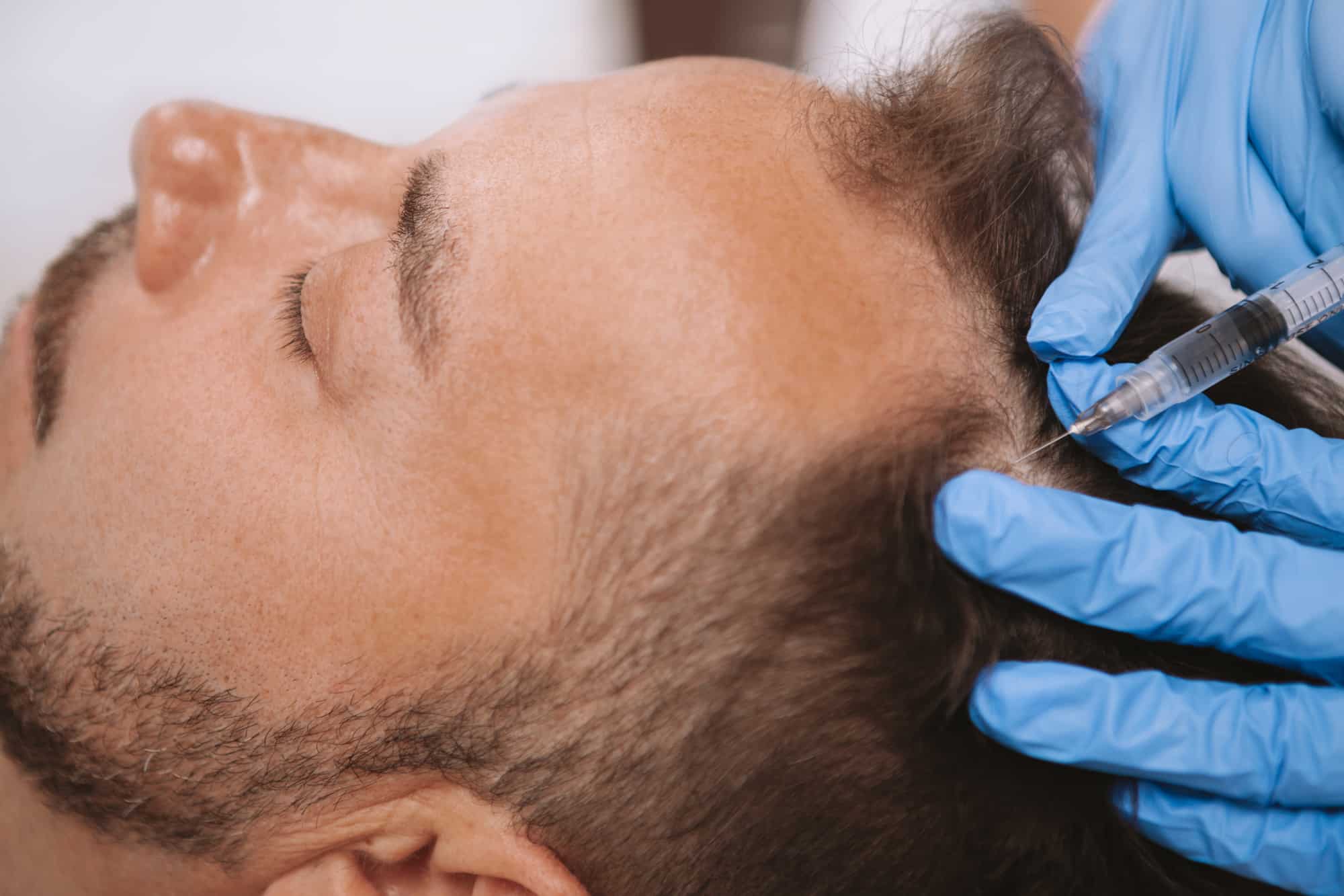 Hair Loss Treatment Chicago IL