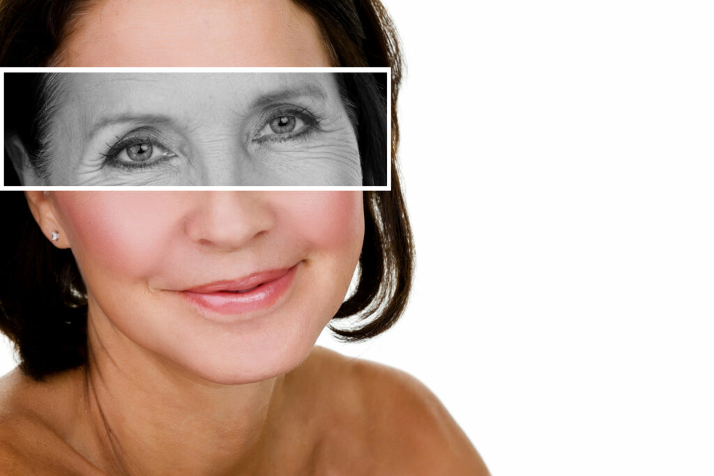 Botox Cosmetic Injections Treatment Chicago IL