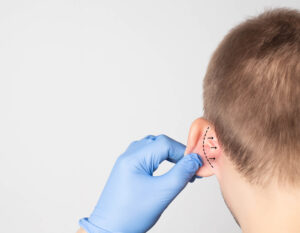 A surgeon examining a child's ears for otoplasty