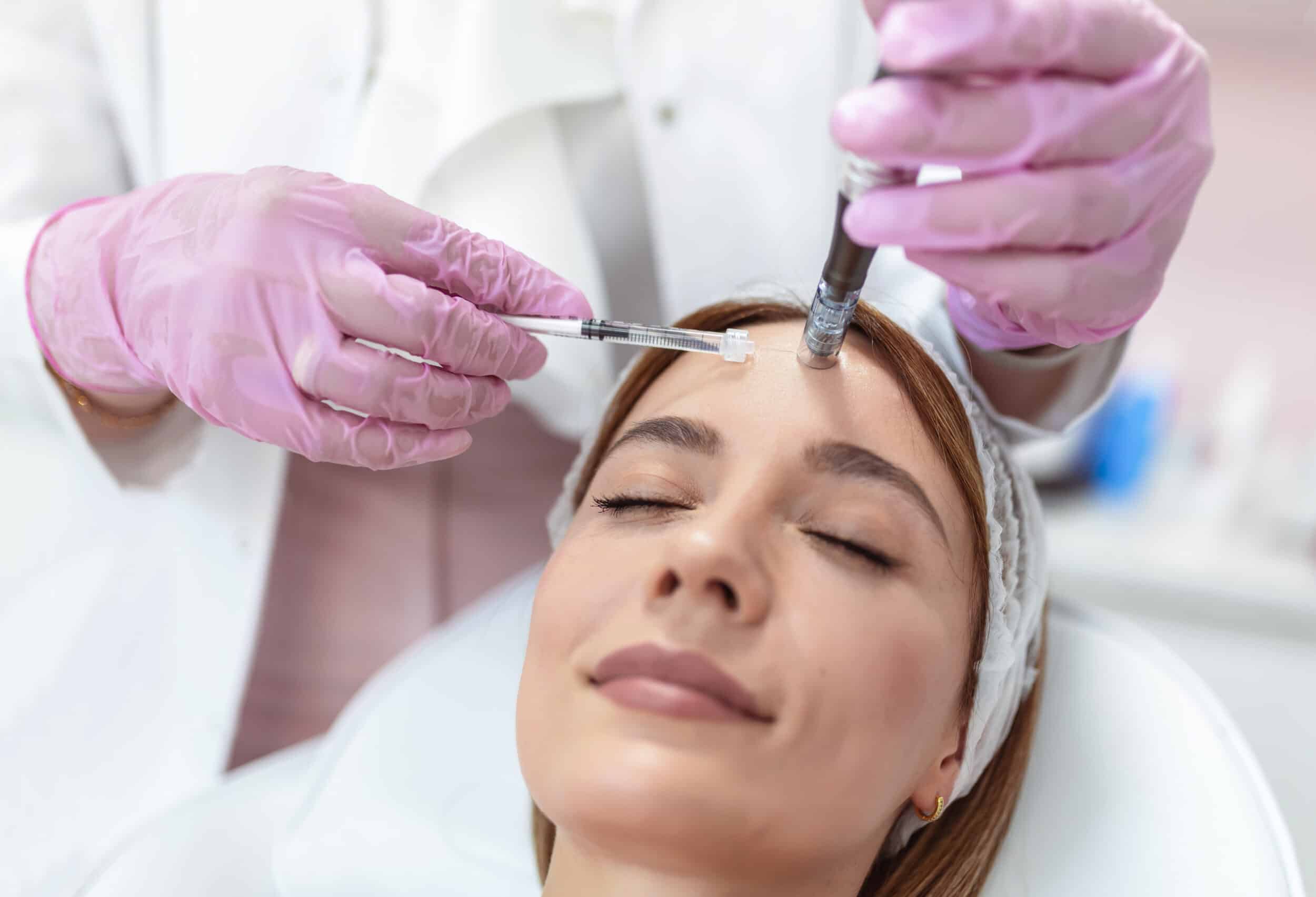 Close up of microneedling on a young beautiful woman's face