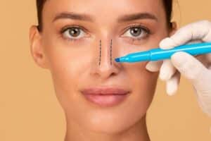 Woman has a new figure after significant weight loss. Plastic surgeon marks up his patients nose prior to rhinoplasty.