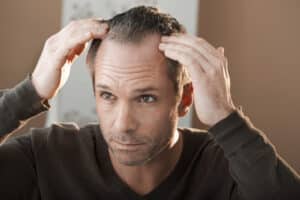 Woman has a new figure after significant weight loss. Man with widow's peak examines hair loss ahead of consultation.